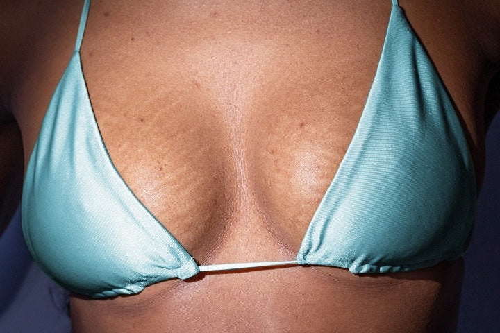 Breast Firming Treatment- What You Need to Know