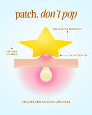 Our Stars Prevent Scars Blemish Patches